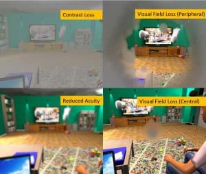 Image of 4 scenes demonstrating different eye conditions in the virtual reality headset